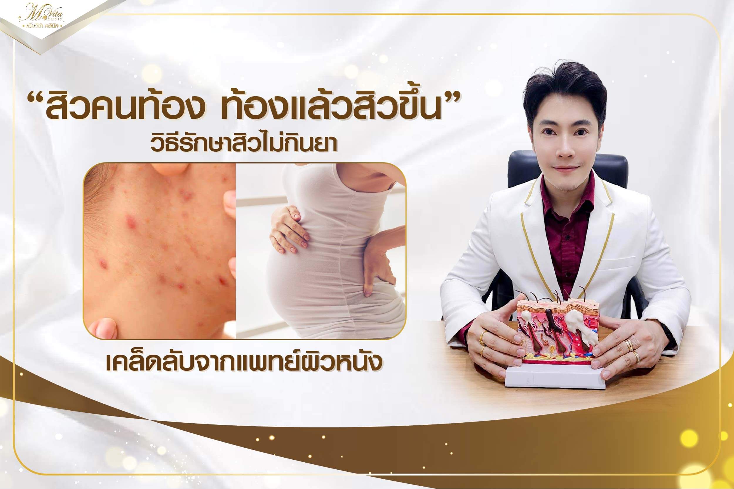 สิวคนท้อง ท้องแล้วสิวขึ้น วิธีรักษาสิวไม่กินยา เคล็ดลับจากแพทย์ผิวหนัง