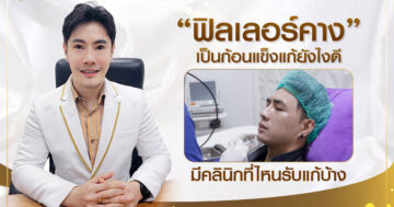 ฟิลเลอร์คาง เป็นก้อนแข็งแก้ยังไงดี