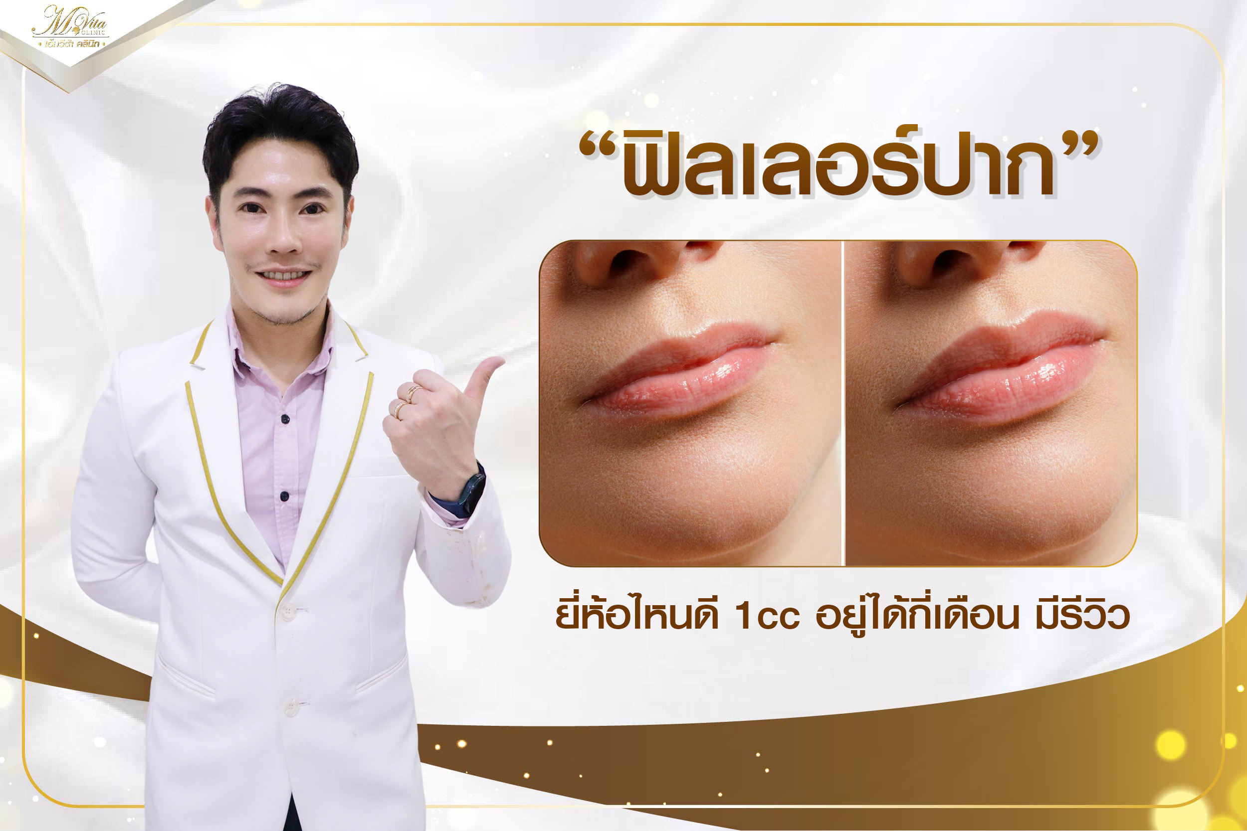 ฟิลเลอร์ปาก ยี่ห้อไหนดี 1 cc อยู่ได้กี่เดือน มีรีวิว