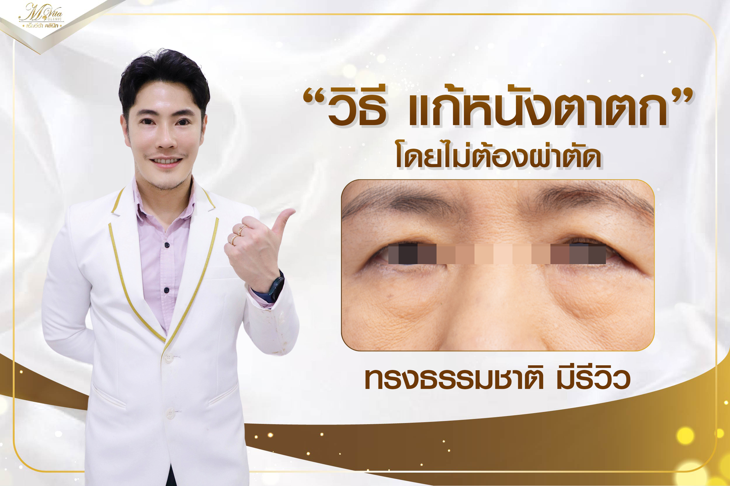 วิธี แก้หนังตาตก โดยไม่ต้องผ่าตัด ทรงธรรมชาติ มีรีวิว