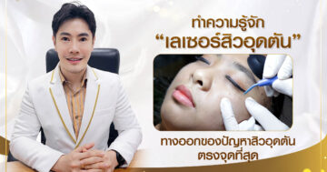 เลเซอร์สิวอุดตัน