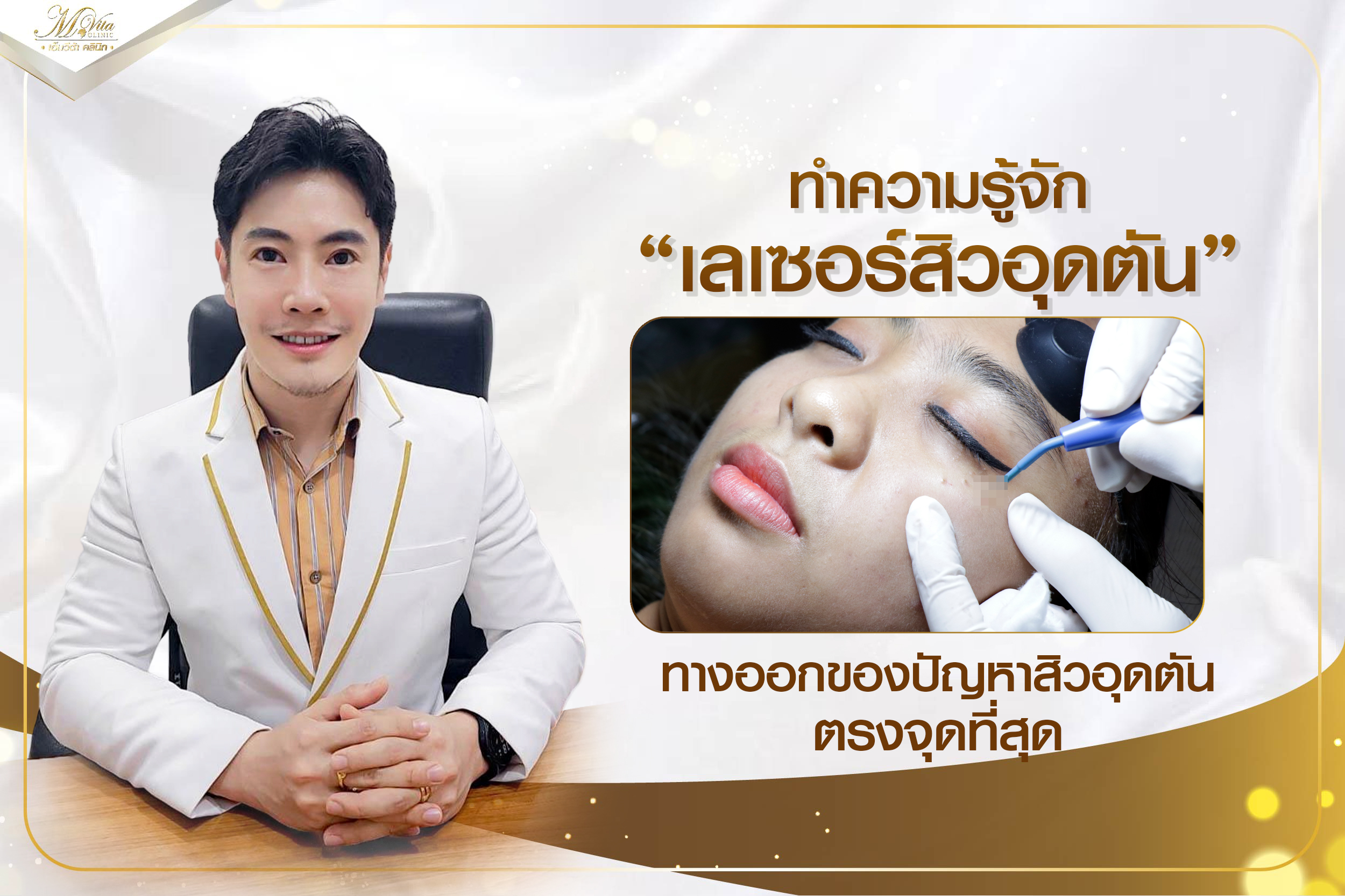 ทำความรู้จัก เลเซอร์สิวอุดตัน ทางออกของปัญหาสิวอุดตันที่ตรงจุดที่สุด