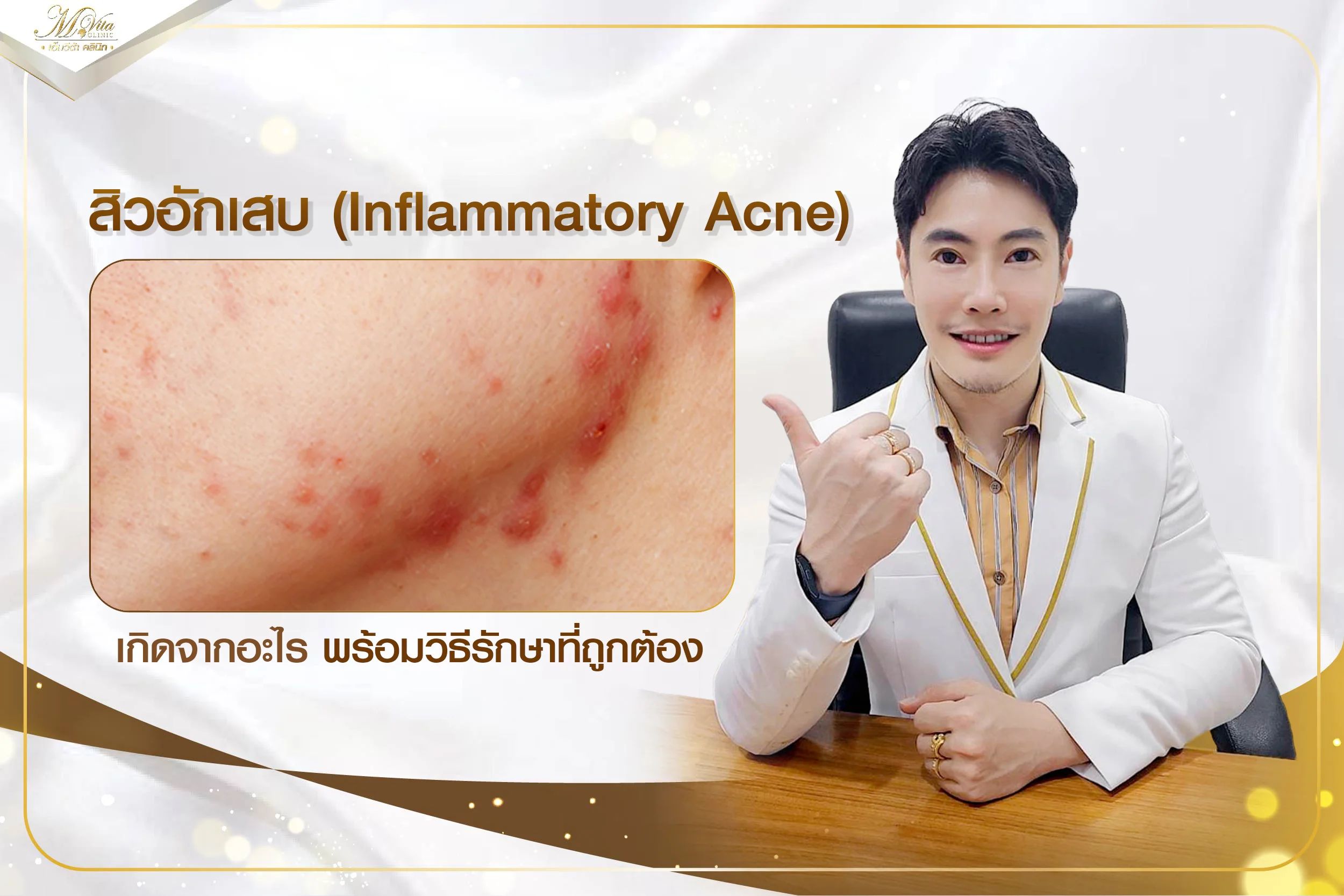 สิวอักเสบขึ้นไม่หยุด เกิดจากสาเหตุอะไร มีวิธีรักษาและป้องกันสิวยังไงบ้าง