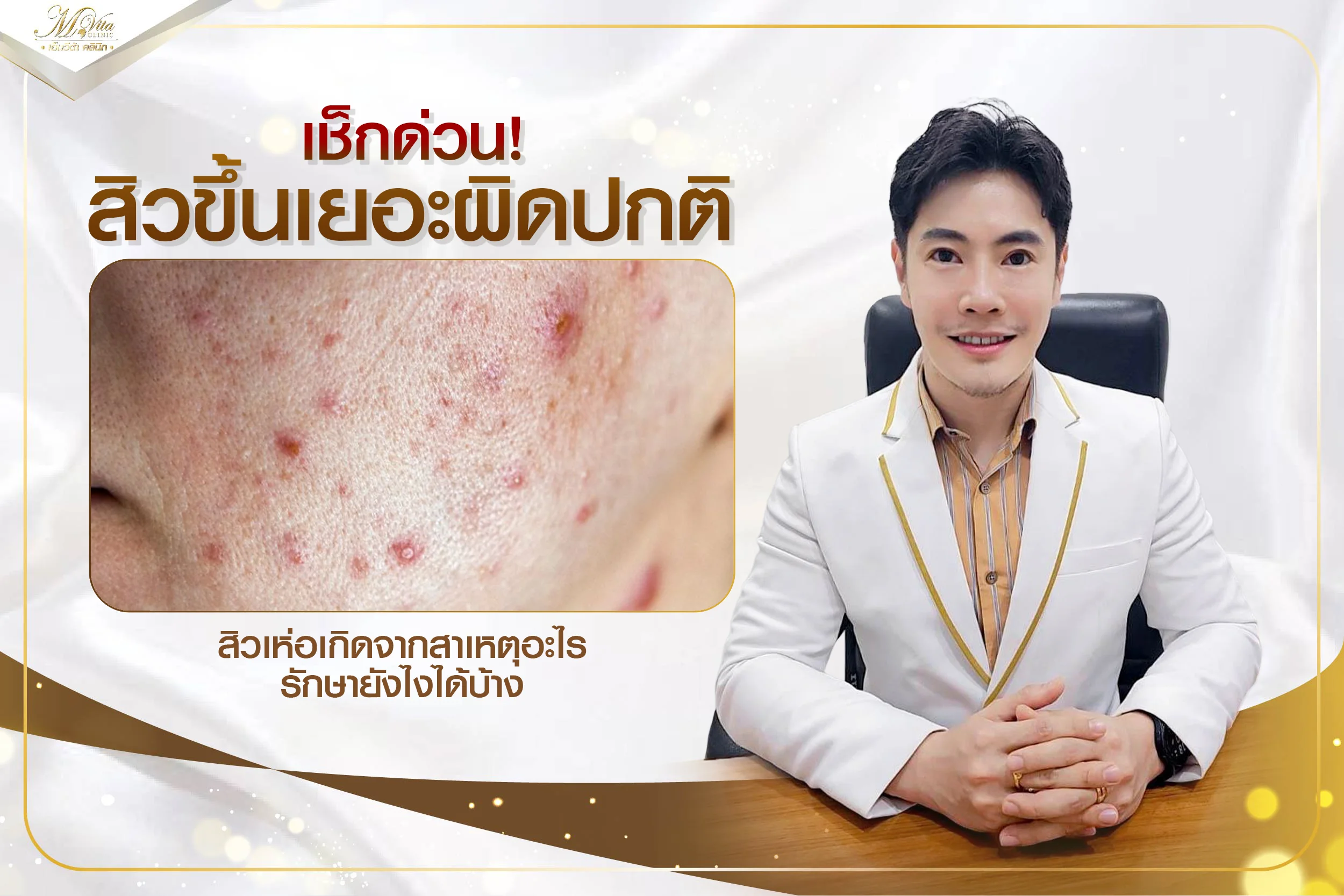 ทำไมสิวขึ้นเยอะผิดปกติ สิวเห่อเกิดจากอะไร มีวิธีรักษาและป้องกันยังไงบ้าง