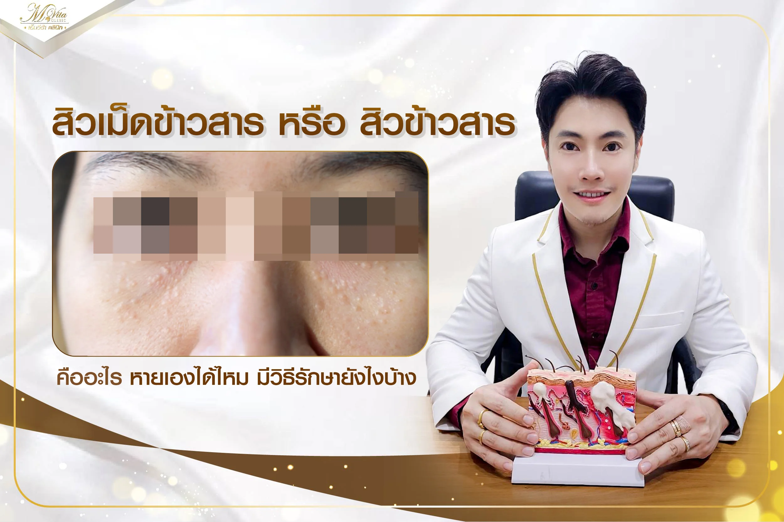 สิวเม็ดข้าวสารเกิดจากอะไร มีวิธีรักษาและป้องกันอย่างไรถึงจะได้ผล
