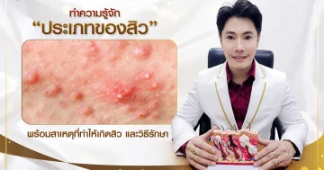รู้จักประเภทของสิว แต่ละประเภทต่างกันยังไง พร้อมแนะนำวิธีรักษา