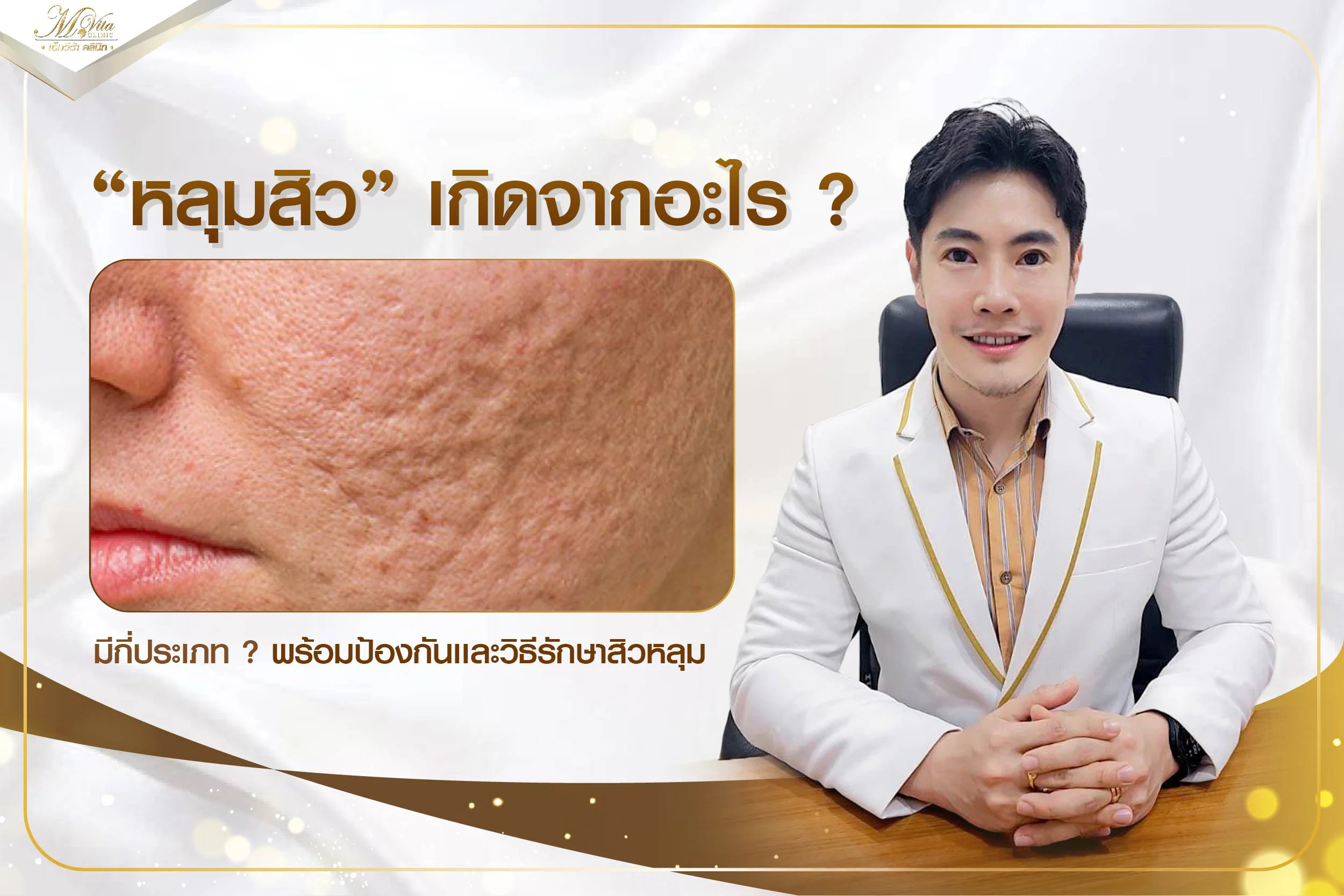 หลุมสิวเกิดจากอะไร รักษาหน้าเป็นหลุมยังไงให้ผิวกลับมาเรียบเนียน