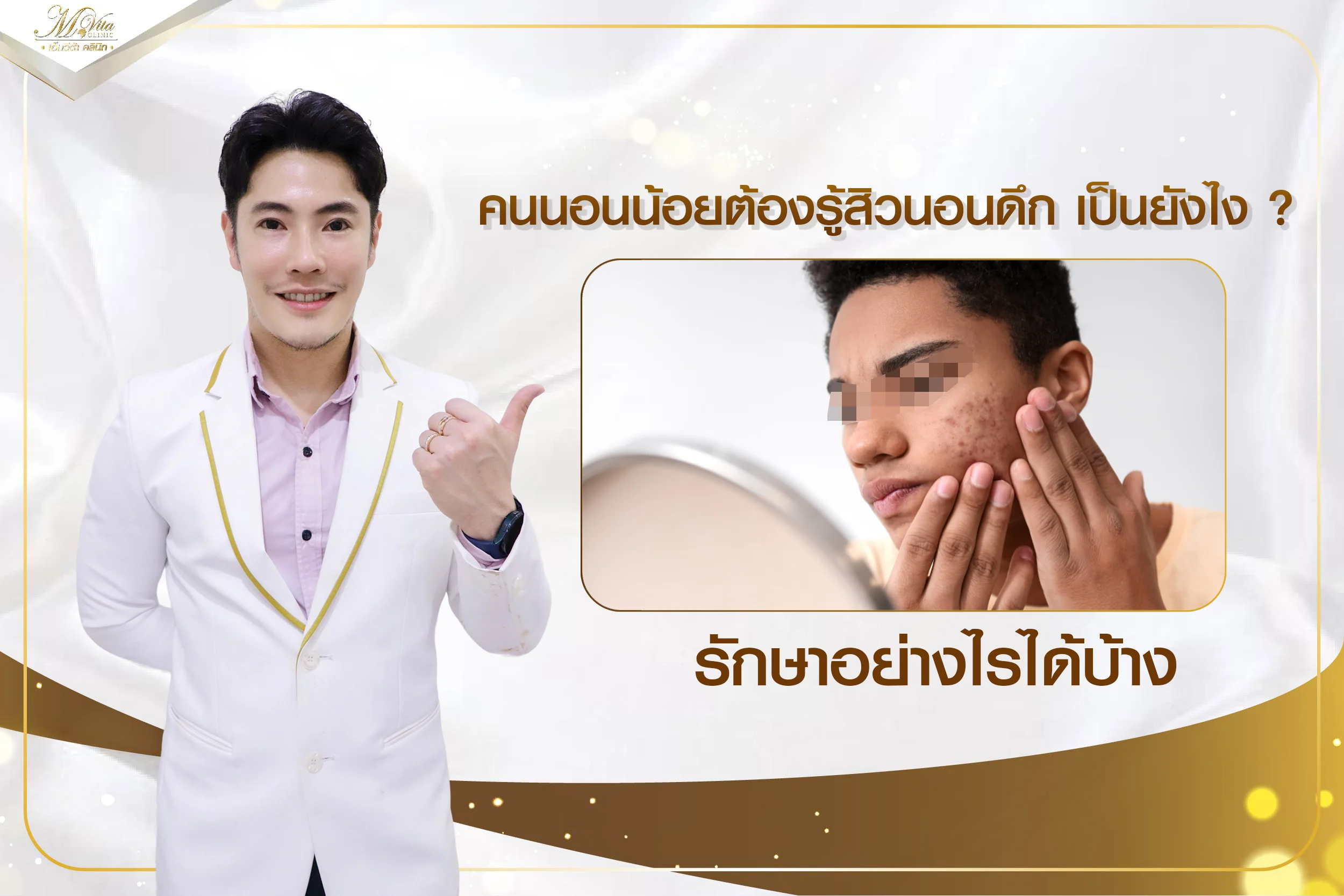 คนนอนน้อยต้องรู้ สิวนอนดึก เป็นยังไง รักษาอย่างไรได้บ้าง