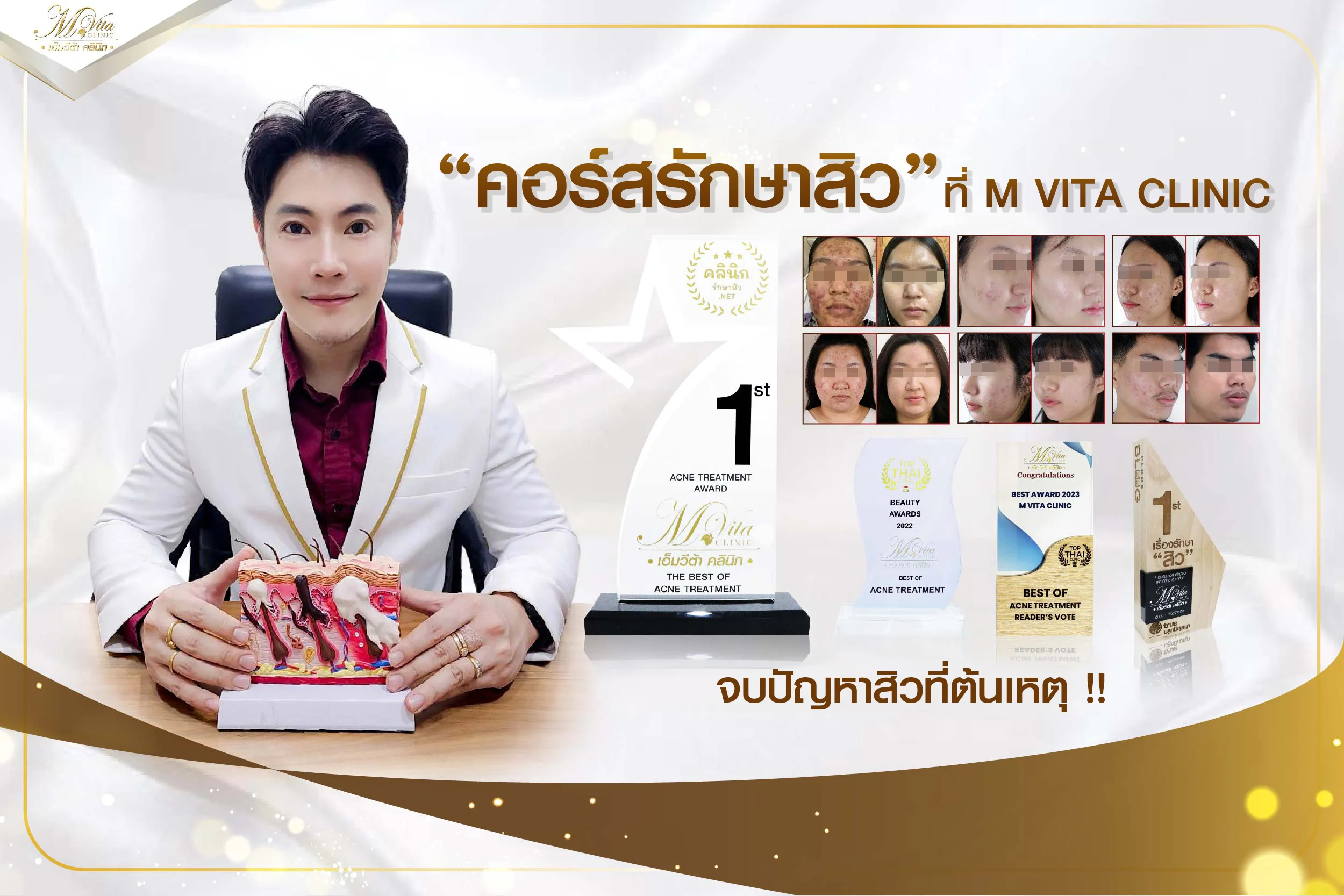 คอร์สรักษาสิว ราคา เฉลี่ยเริ่มต้น 720 จบปัญหาสิวที่ M VITA CLINIC