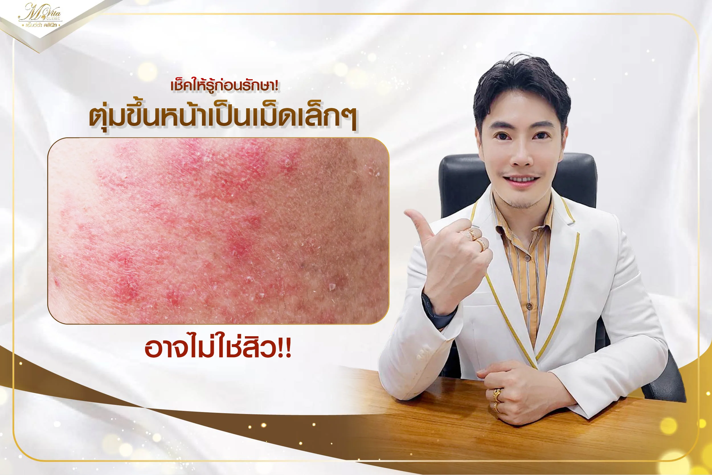 เช็คให้รู้ก่อนรักษา! ตุ่มขึ้นหน้าเป็นเม็ดเล็กๆ อาจไม่ใช่สิว