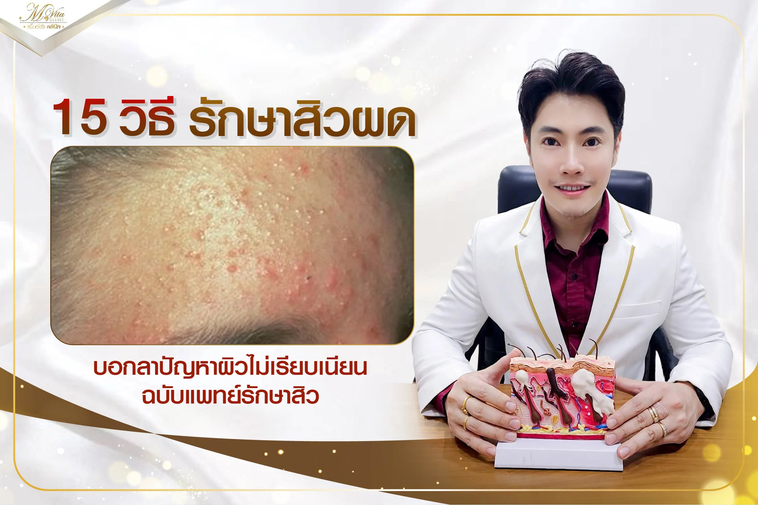 รวม 15 วิธีรักษาสิวผด กู้ผิวหน้า บอกลาผิวไม่เรียบเนียน ฉบับหมอรักษาสิว