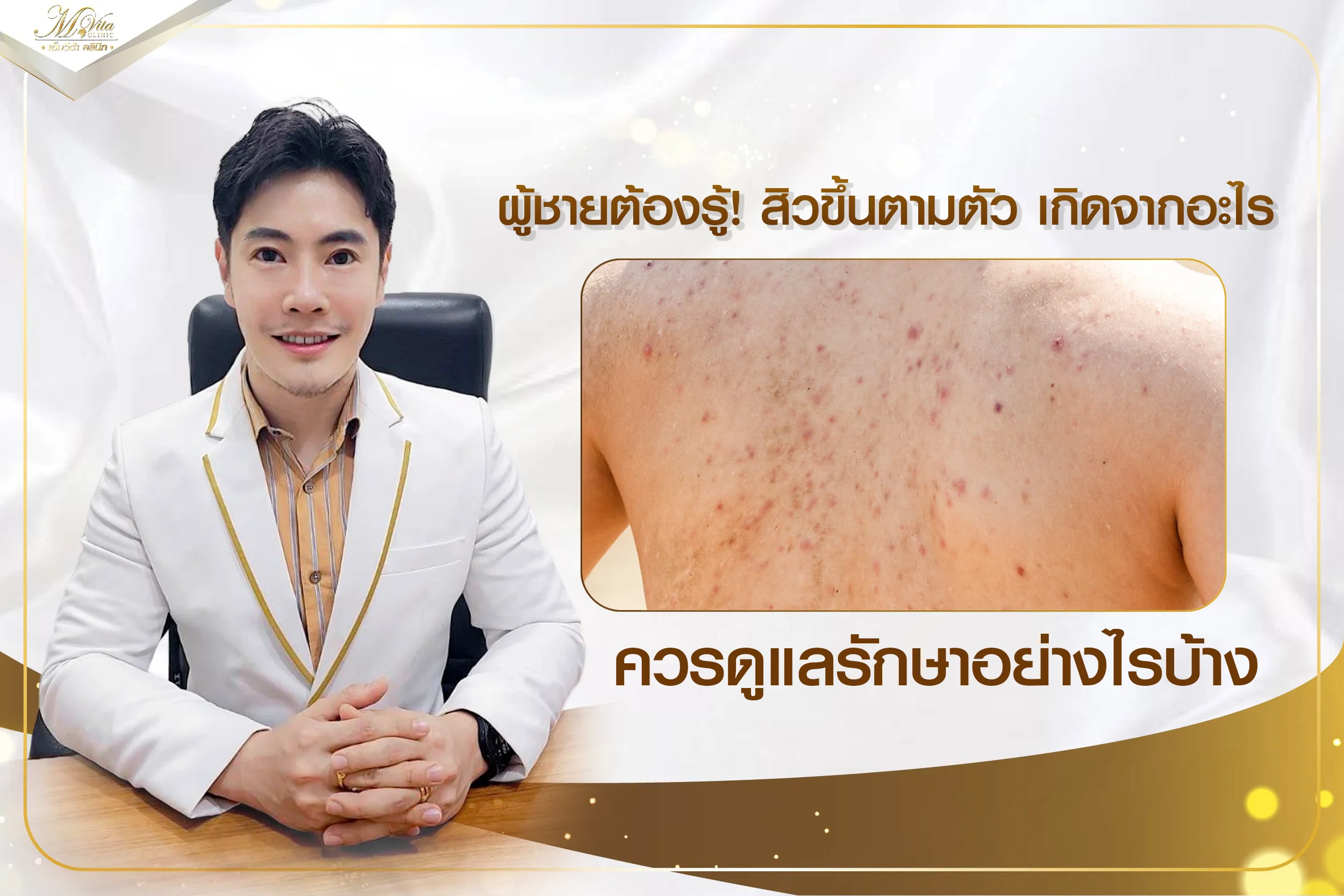 รวมปัญหาสิวขึ้นตามตัวที่ต้องรู้ พร้อมวิธีดูแลรักษาให้ผิวเรียบเนียน