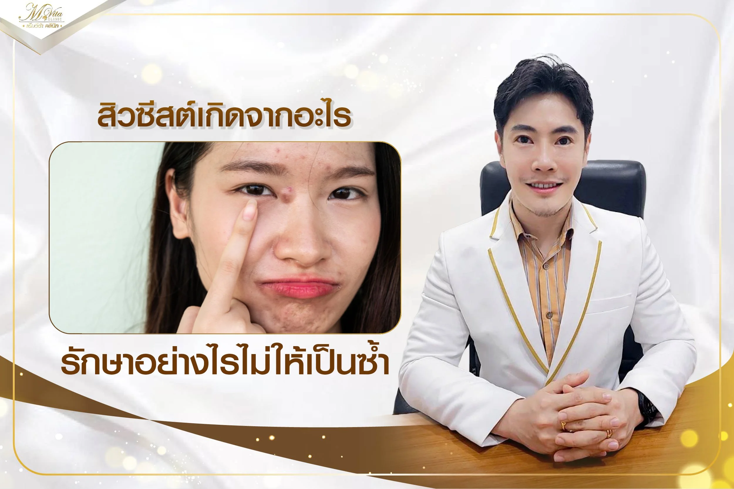 สิวซีสต์เกิดจากอะไร รักษาอย่างไรไม่ให้เป็นซ้ำ