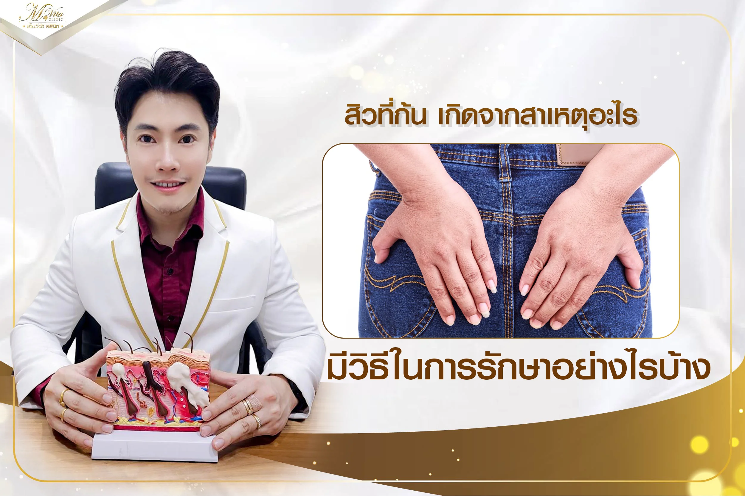 สิวที่ก้น เกิดจากสาเหตุอะไร มีวิธีในการรักษาอย่างไรบ้าง