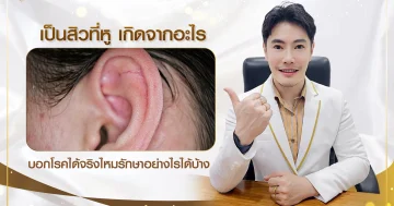 สิวที่หูเกิดจากอะไรได้บ้าง