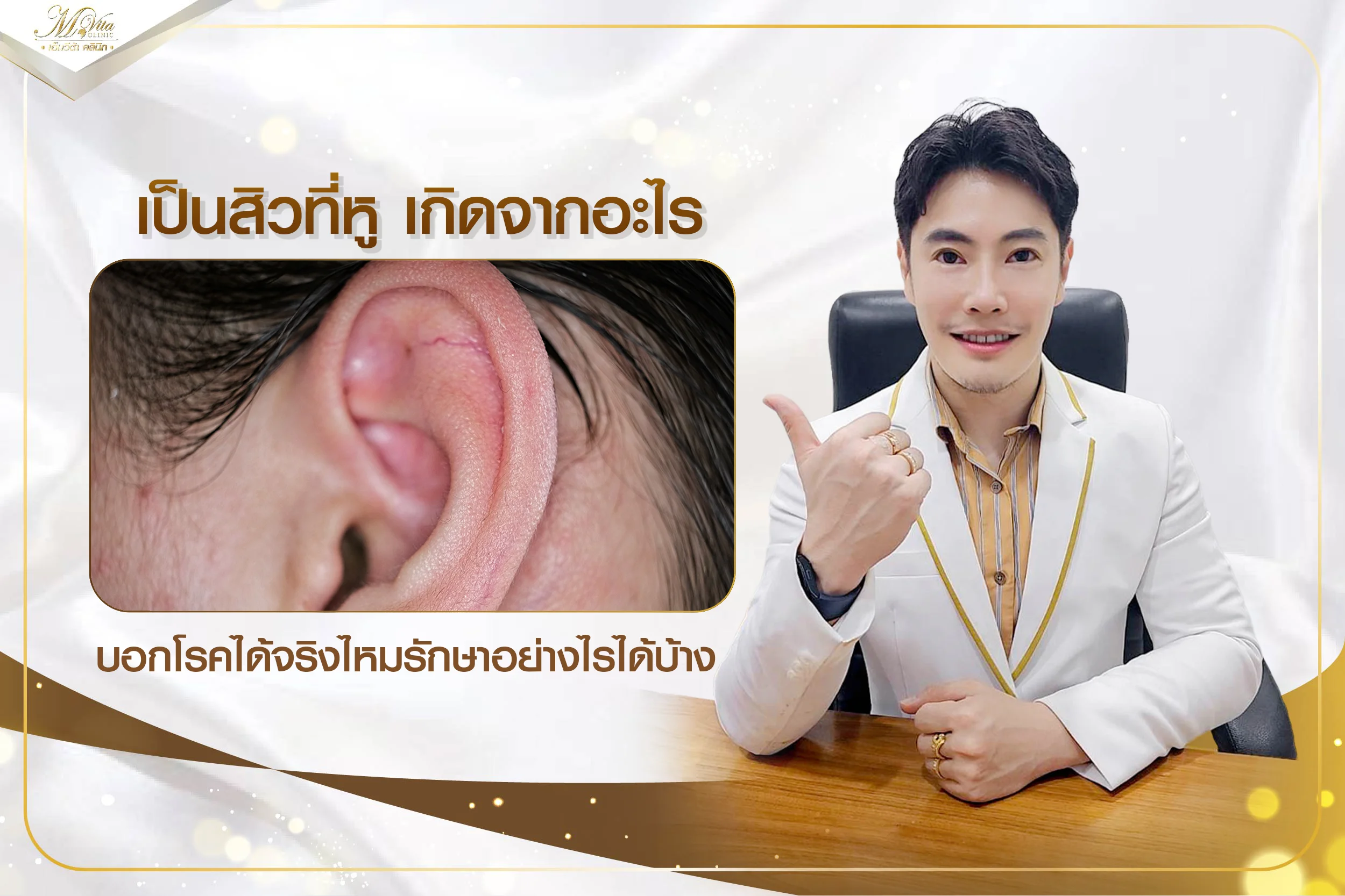 เป็นสิวที่หู บอกโรคได้จริงไหม เกิดจากอะไร จะรักษายังไงได้บ้าง