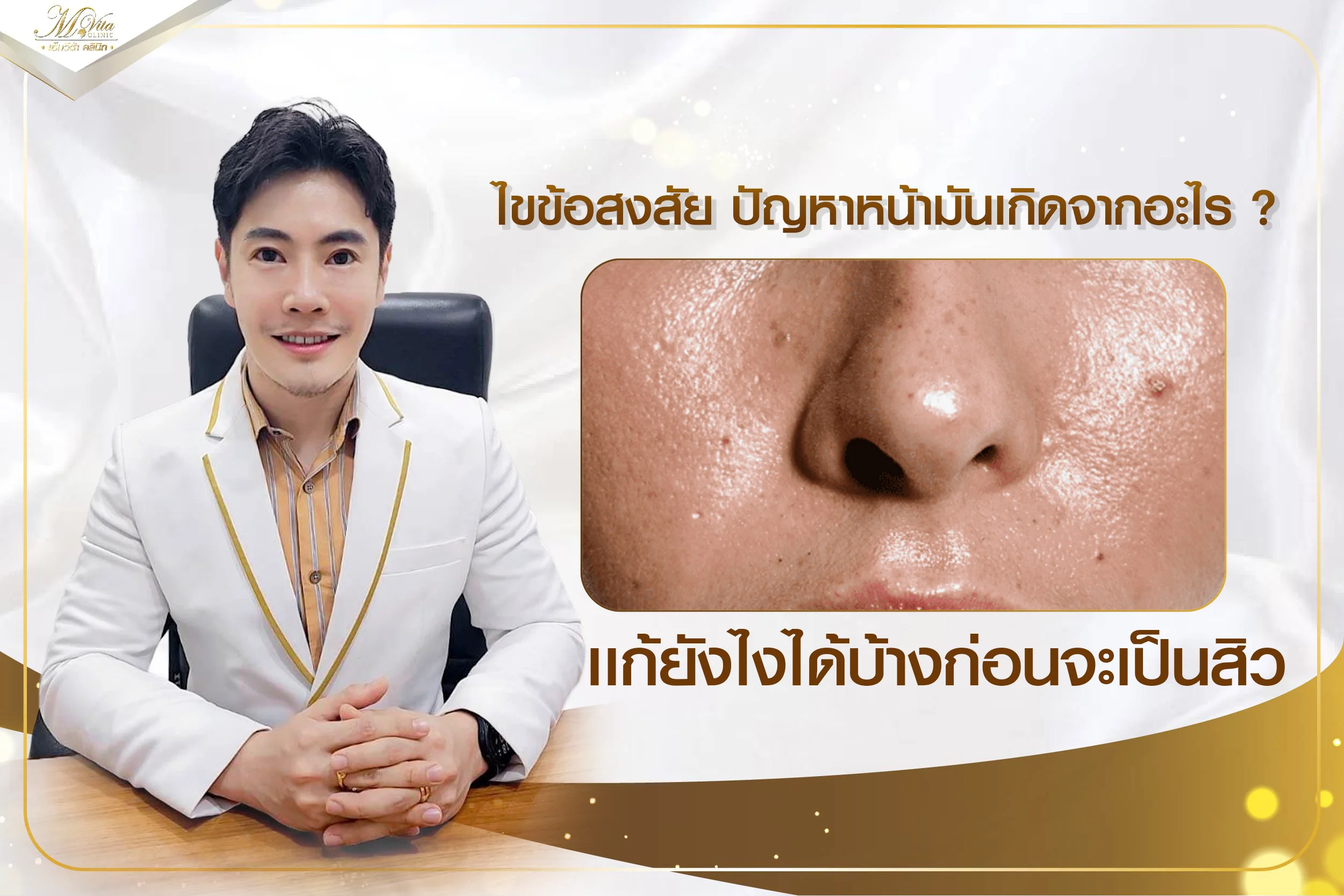 ไขข้อสงสัย ปัญหาหน้ามันเกิดจากอะไร แก้ยังไงได้บ้างก่อนจะเป็นสิว