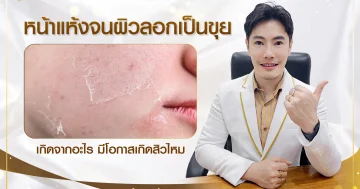 ผิวลอกเป็นขุย