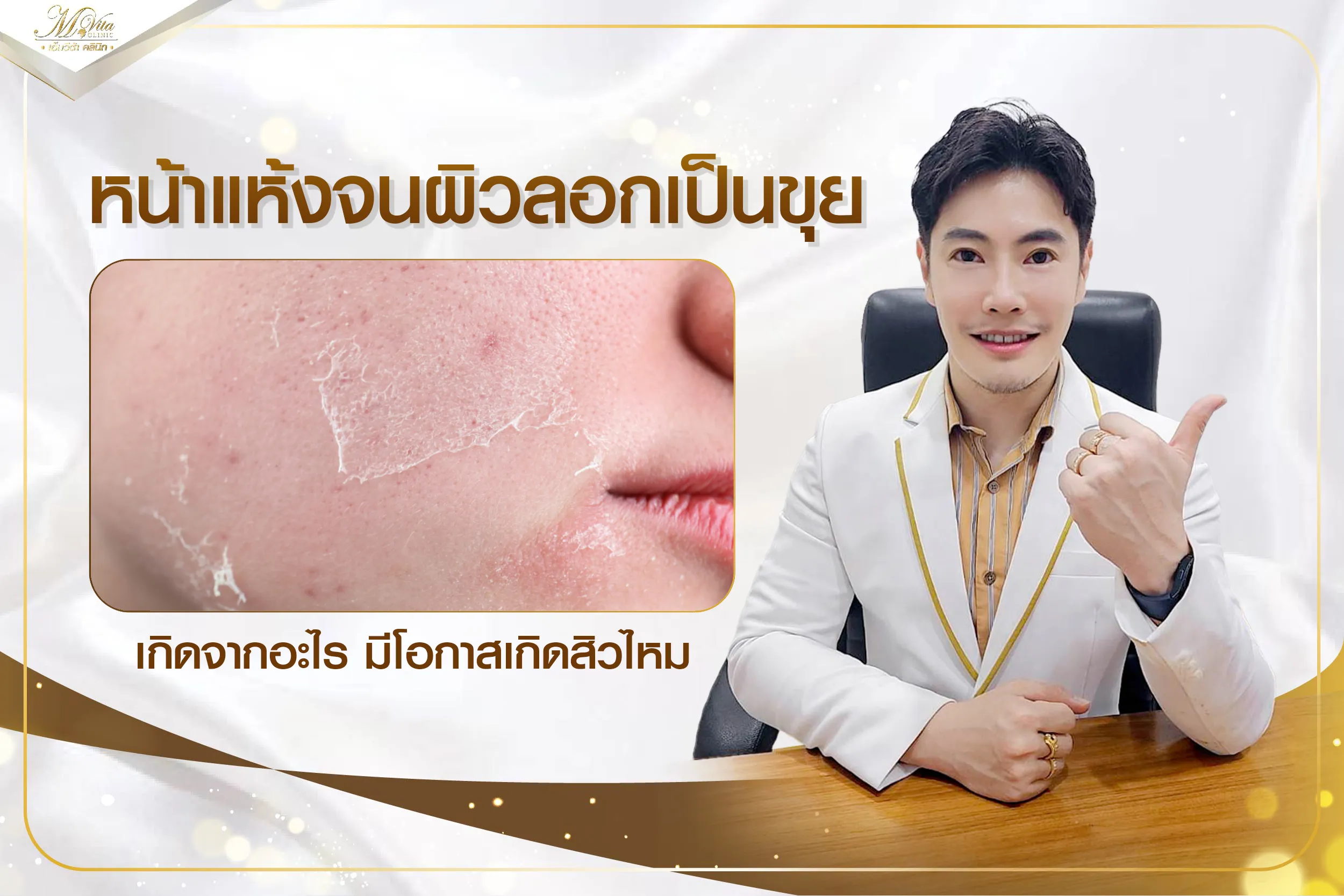 อาการหน้าแห้ง ผิวลอกเป็นขุย หนึ่งในสาเหตุของการเกิดสิว