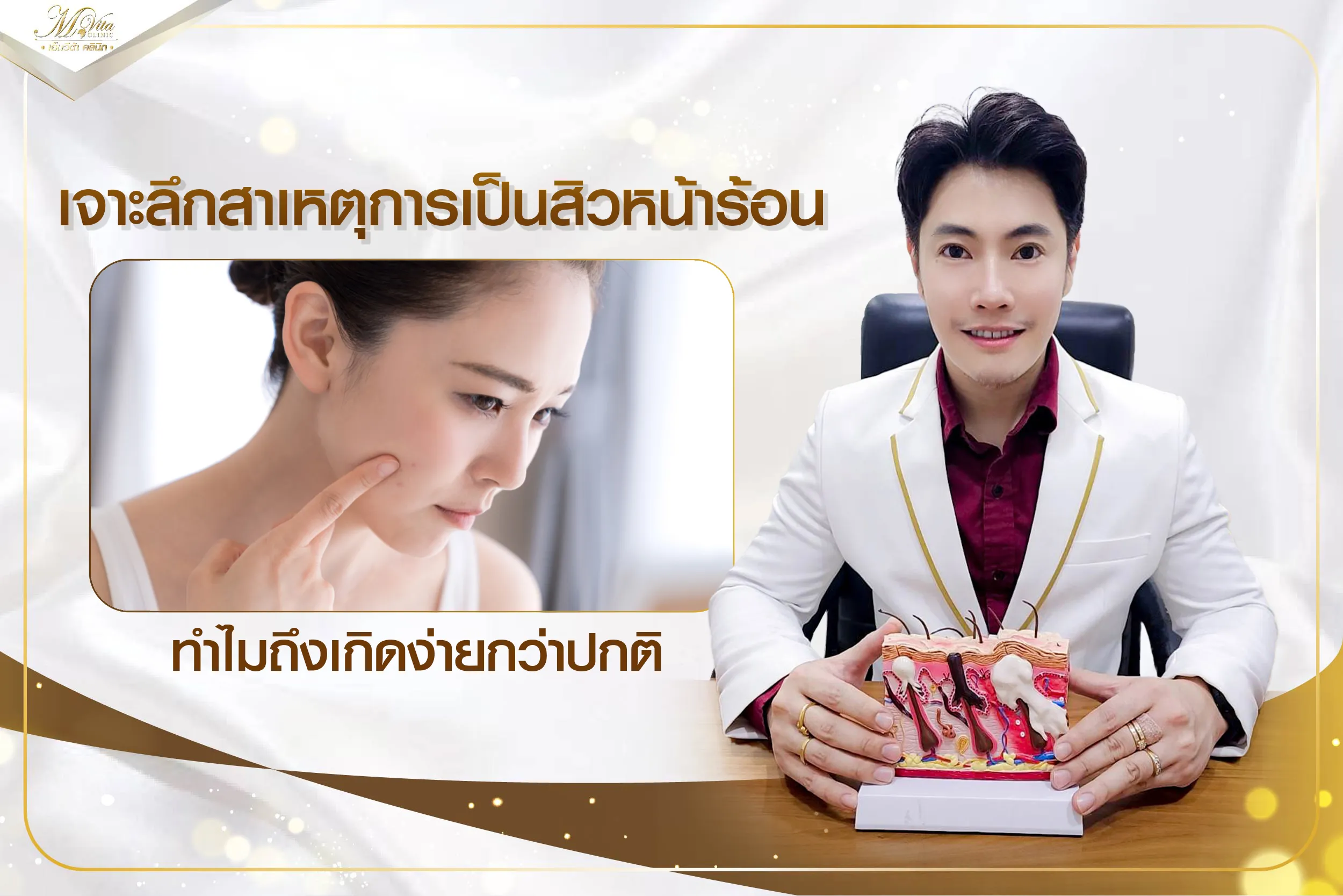 เจาะลึกสาเหตุการเป็นสิวหน้าร้อน ทำไมถึงเกิดง่ายกว่าปกติ
