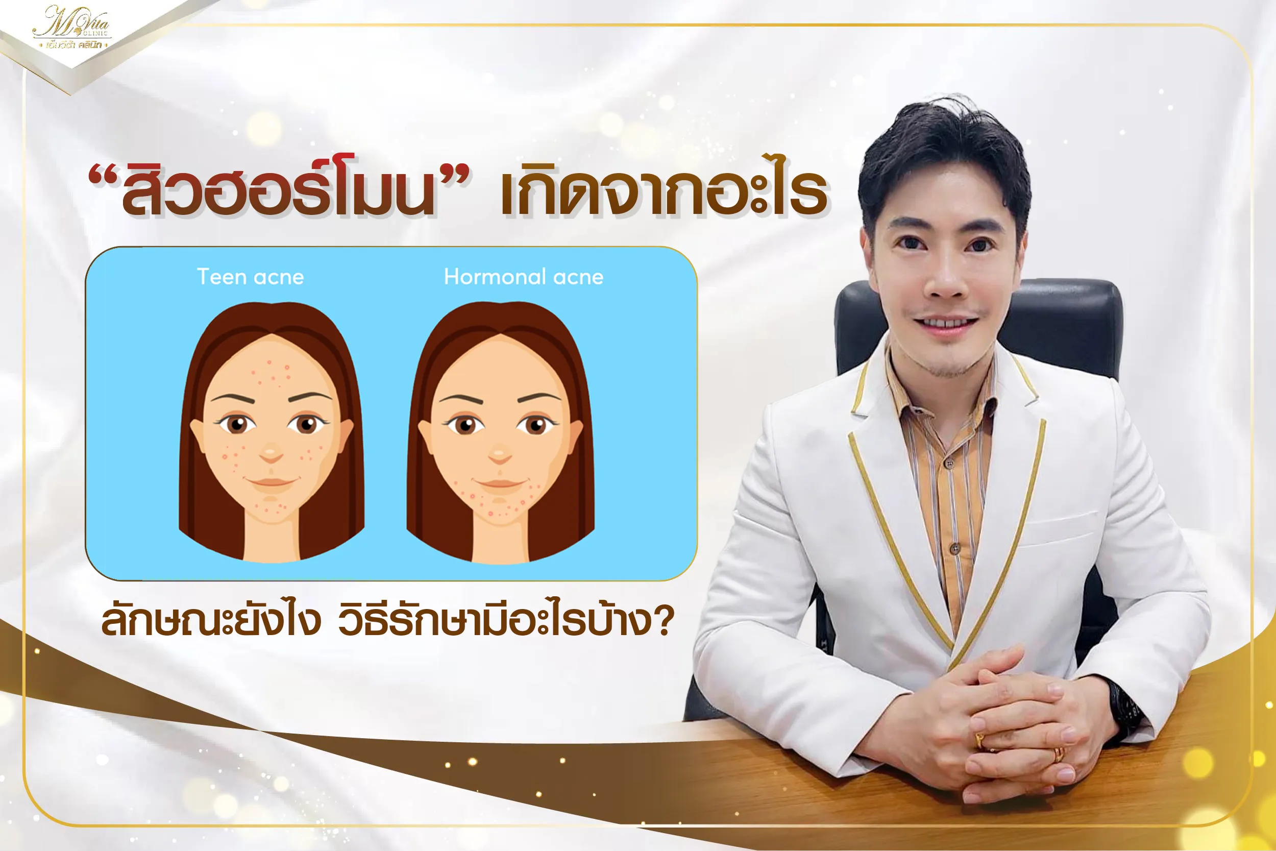 เข้าใจสิวฮอร์โมนเกิดจากอะไร ลักษณะยังไง วิธีรักษาสิวฮอร์โมนมีอะไรบ้าง?