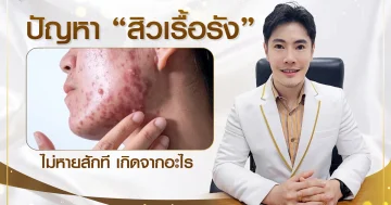 ปัญหาเป็นสิวเรื้อรัง ไม่หายสักที เกิดจากอะไร