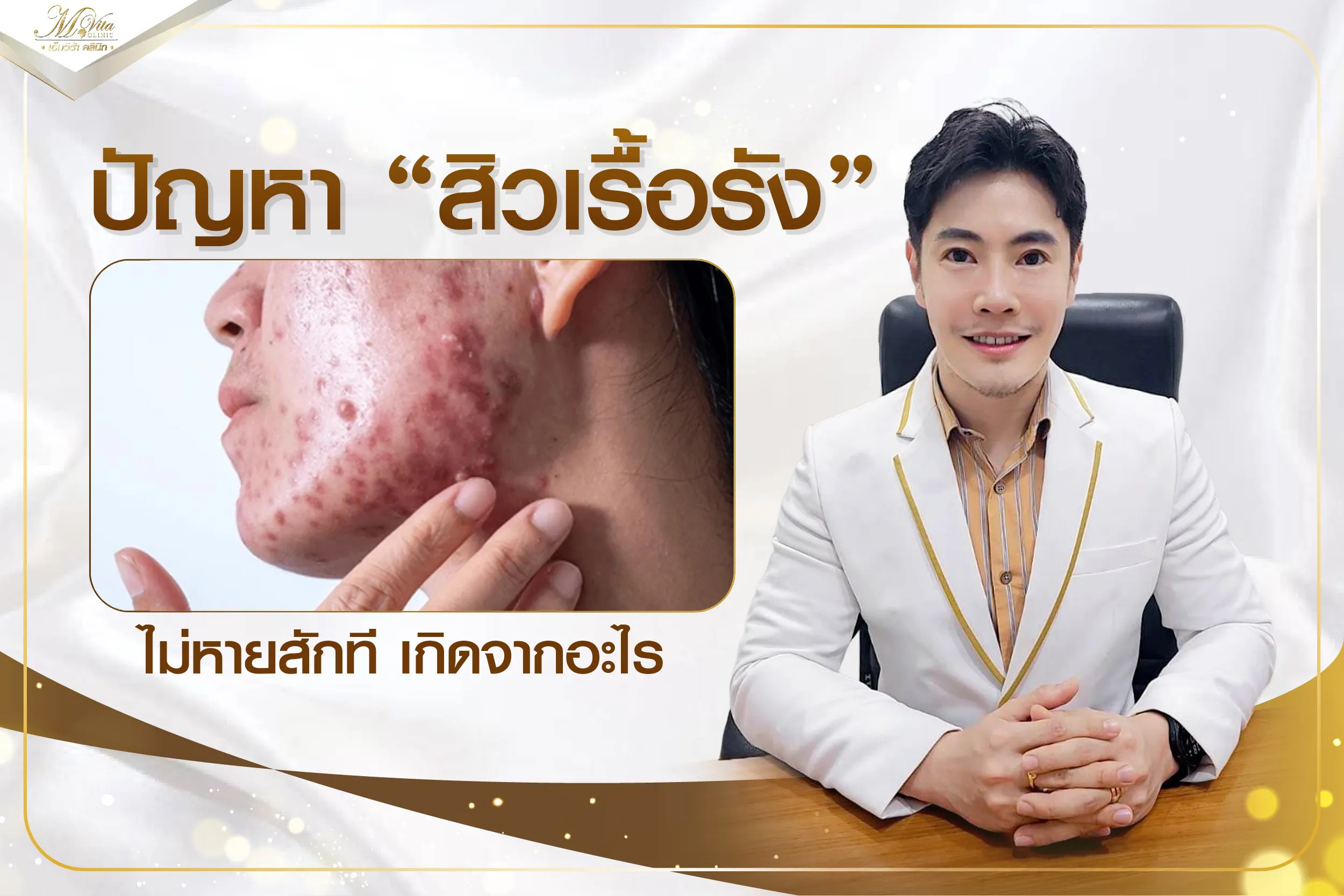 ปัญหาเป็นสิวเรื้อรัง ไม่หายสักที เกิดจากอะไร