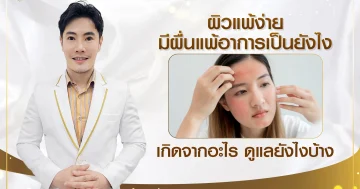 ผิวแพ้ง่าย มีผื่นแพ้อาการเป็นยังไง เกิดจา