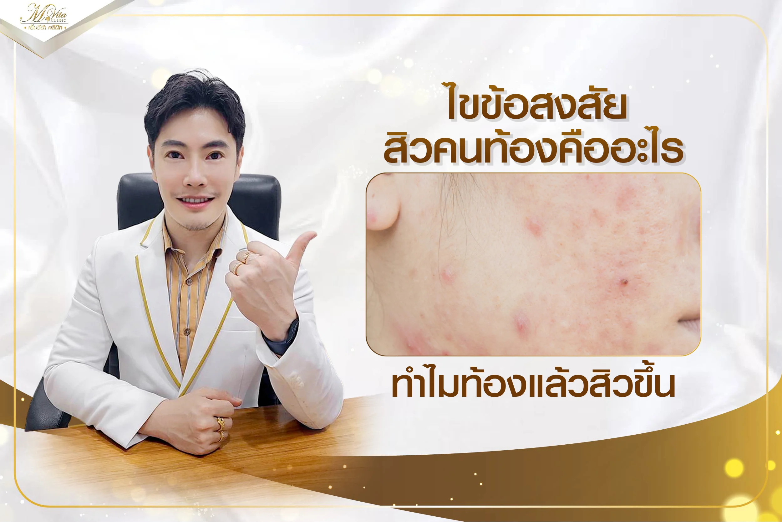 ไขข้อสงสัย สิวคนท้องคืออะไร ทำไมท้องแล้วสิวขึ้น