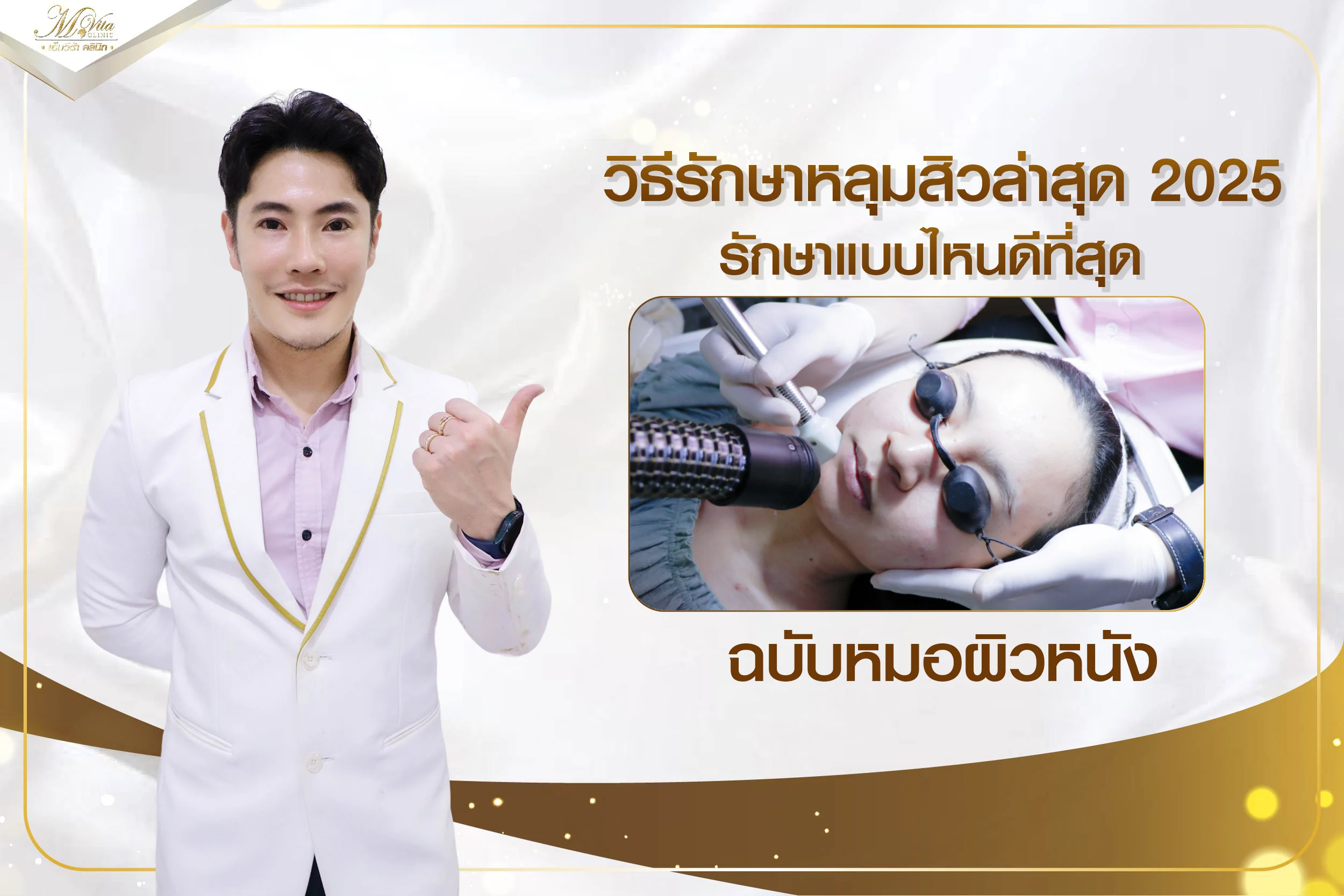 วิธีรักษาหลุมสิวล่าสุด 2025 รักษาแบบไหนดีที่สุด ฉบับหมอผิวหนัง