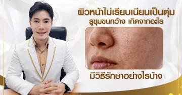 ผิวหน้าไม่เรียบเนียนเป็นตุ่ม รูขุมขนกว้าง เกิดจากอะไร มีวิธีรักษายังไง