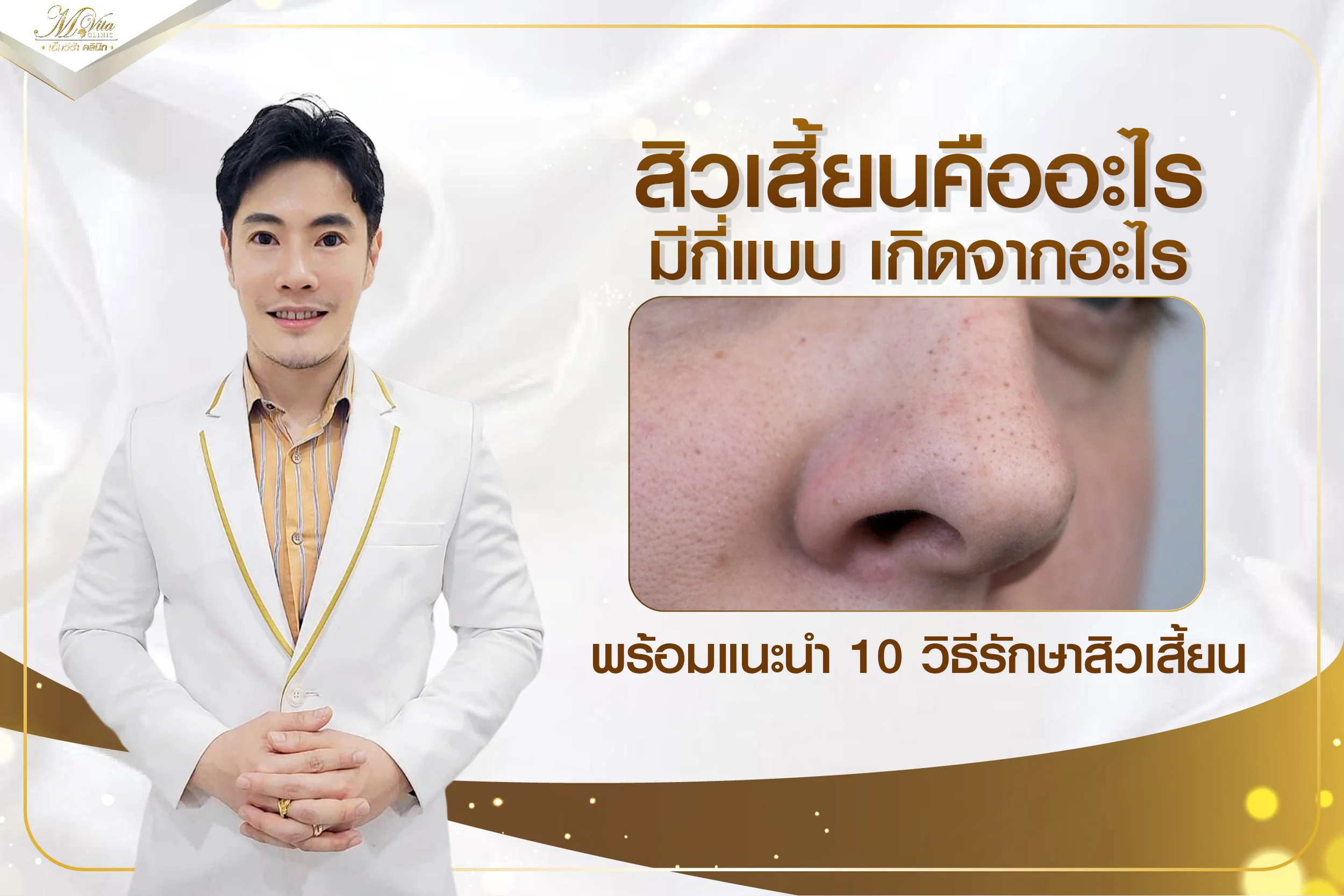 สิวเสี้ยนคืออะไร มีกี่แบบ เกิดจากอะไร พร้อมแนะนำ 10 วิธีรักษาสิวเสี้ยน