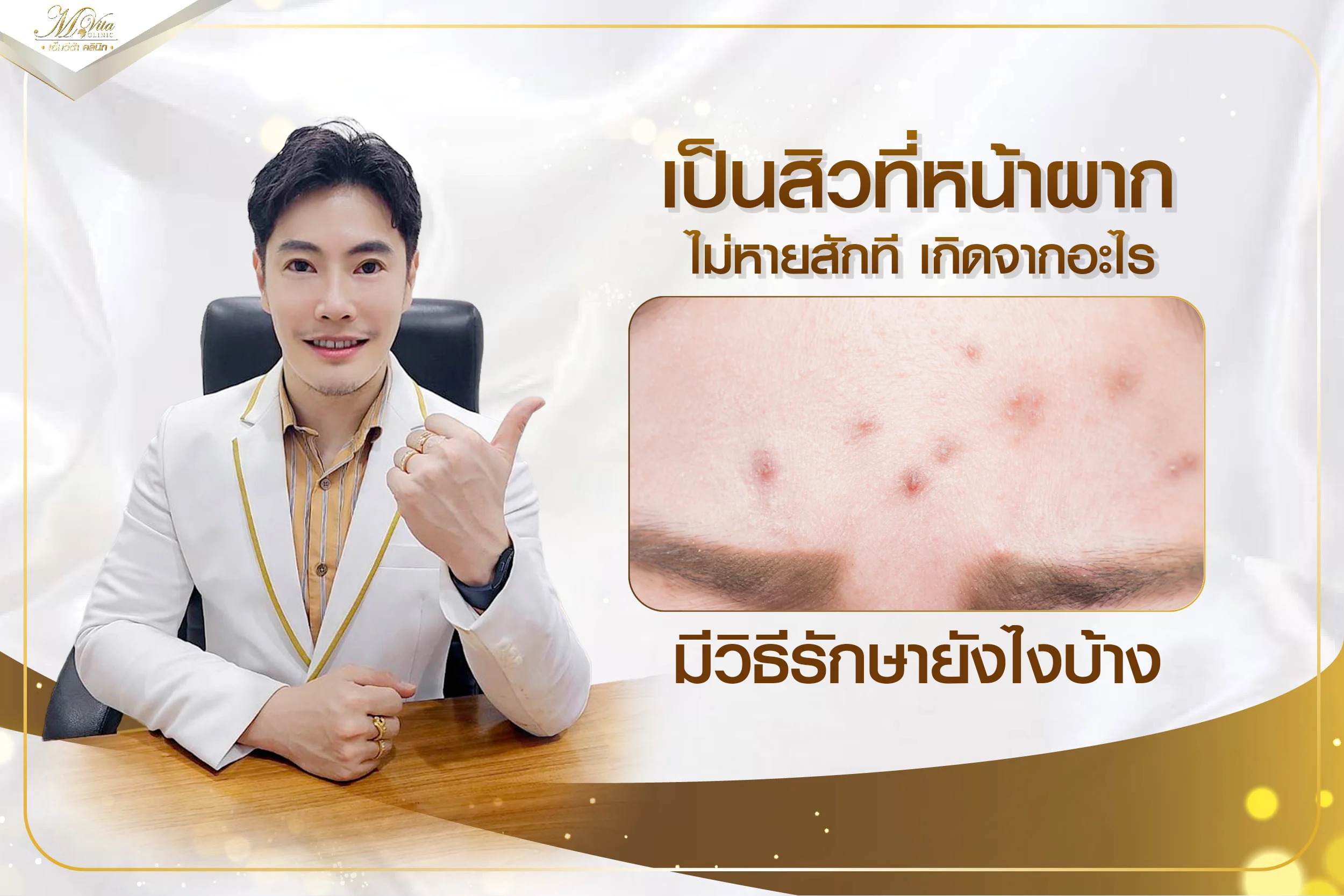 เป็นสิวที่หน้าผากไม่หายสักทีเกิดจากอะไร มีวิธีรักษาและป้องกันยังไงบ้าง