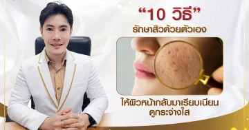 10 วิธีรักษาสิวด้วยตัวเอง ให้ผิวหน้ากลับมาเรียบเนียน ดูกระจ่างใส