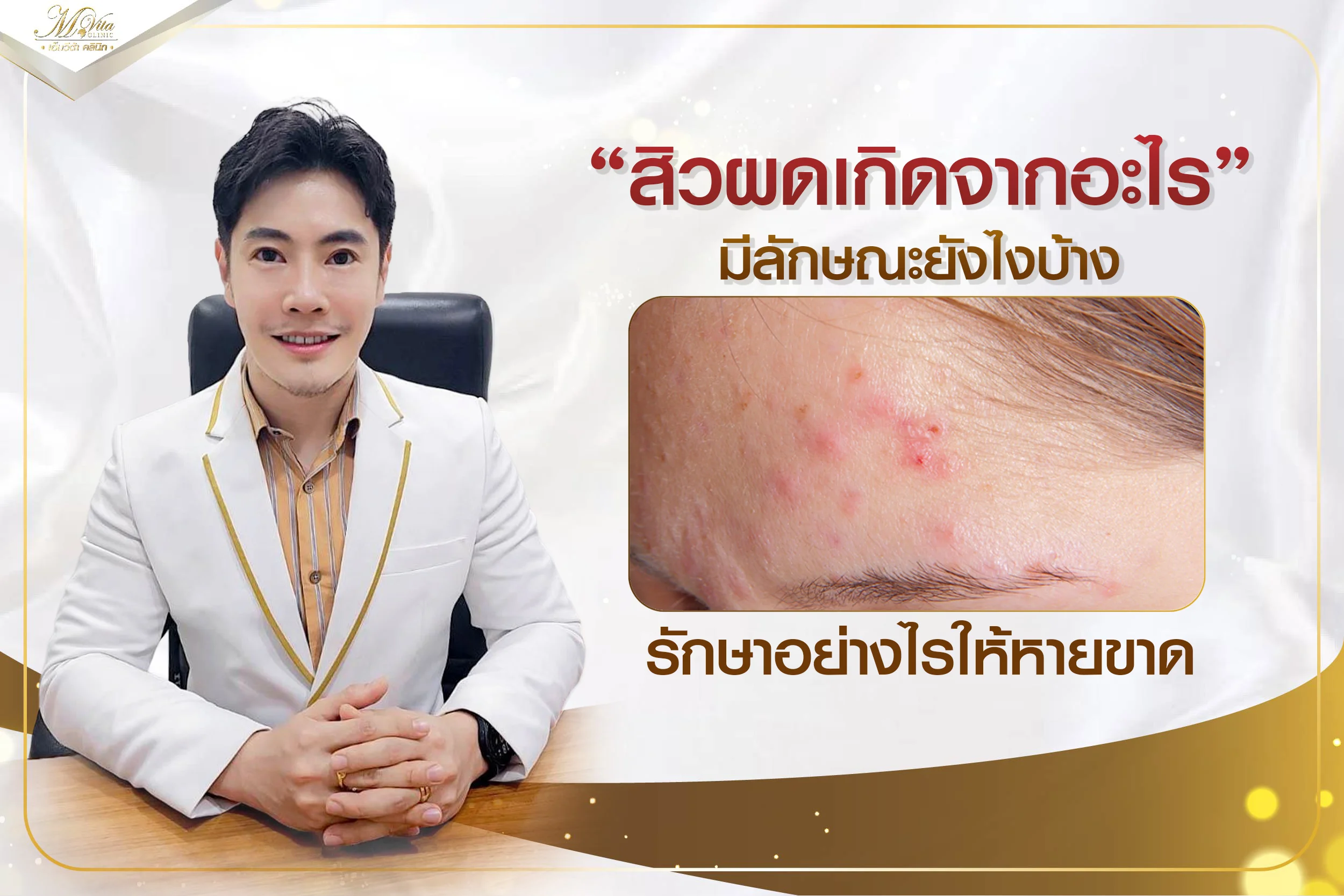 สิวผดเกิดจากอะไร มีวิธีป้องกันและรักษาสิวผดอย่างไรบ้าง